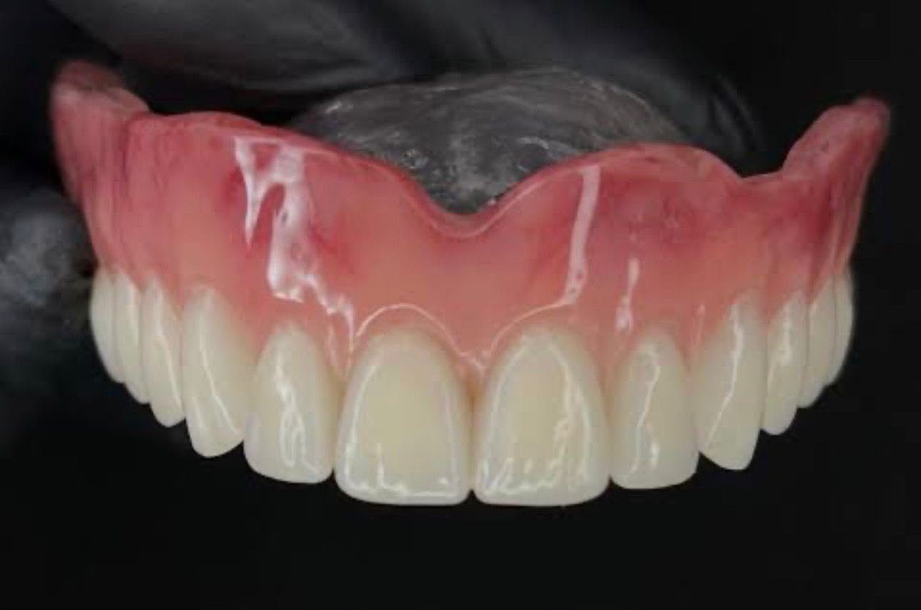 Prótese dental
