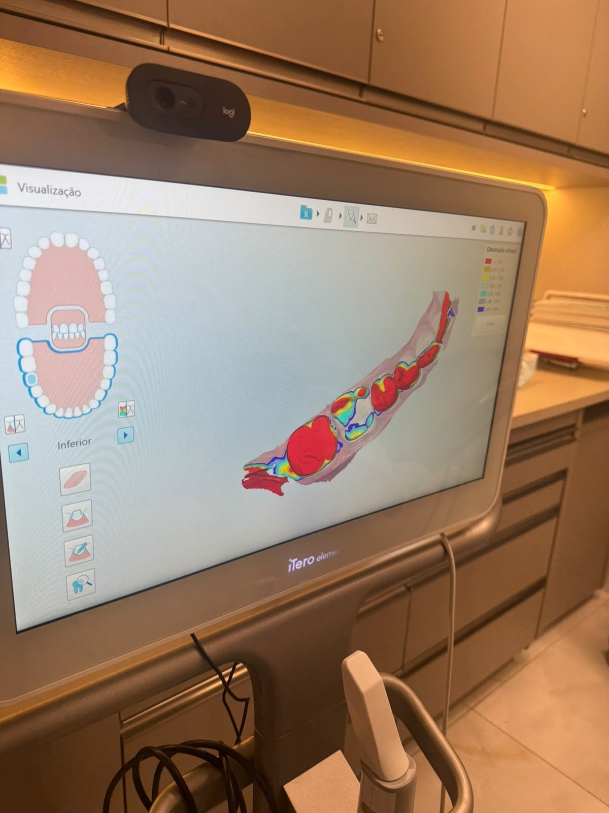 Scanner intraoral digital iTero em uso na clínica